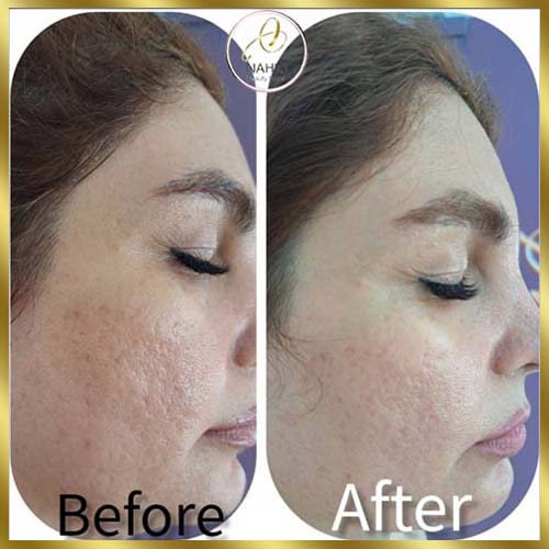 گالری پاکسازی پوست